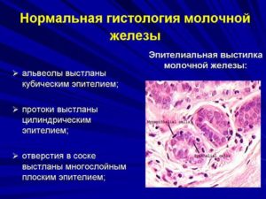 Гистология молочной железы расшифровка