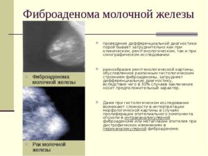 Может ли фиброаденома молочной железы перерасти в рак