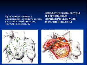 Регионарные лимфатические узлы молочной железы