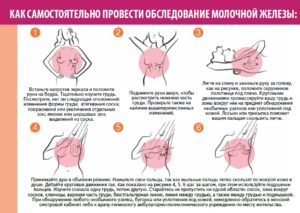 Как обследовать молочную железу самостоятельно