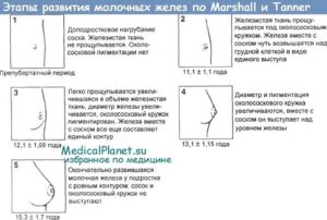 Развитие молочных желез у девочек