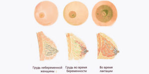 Болит молочная железа после кормления