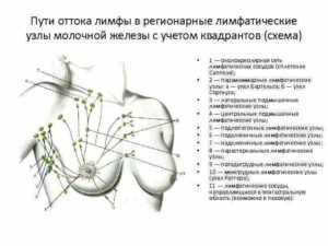 Лимфоузлы в молочной железе