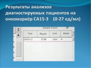 Онкомаркер молочной железы са 15 3 расшифровка