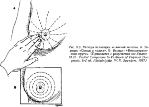 Пальпация молочной железы алгоритм
