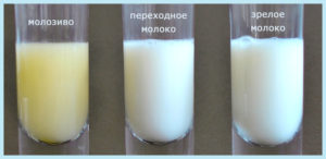 Из молочной железы выделяется молозиво