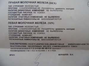 Заключение узи молочных желез