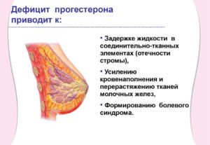 Болезни молочной железы у женщин после 50 лет