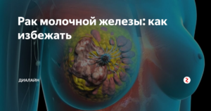 Как предотвратить рак молочной железы