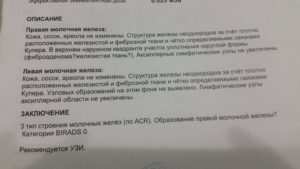 Расшифровка маммографии молочных желез