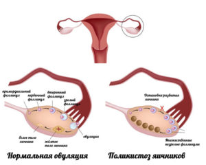 Фолликул в яичнике норма
