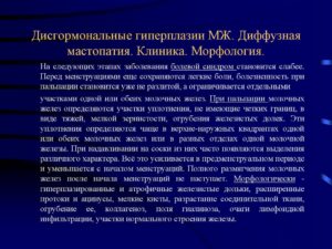 Диффузная дисгормональная гиперплазия молочных желез