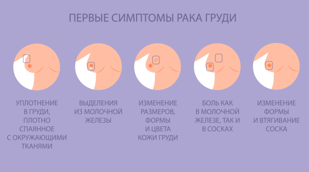 Первые признаки рака молочной железы на ранней стадии у женщин