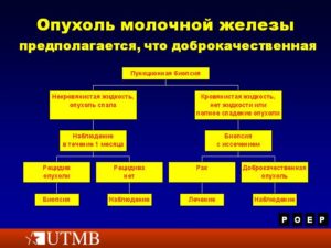 Доброкачественная опухоль молочной железы