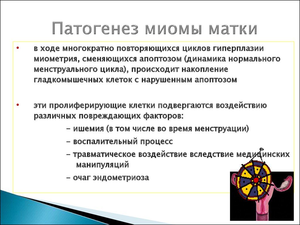 Миома матки патогенез