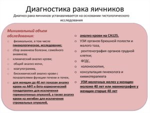 Диагностика рака яичников