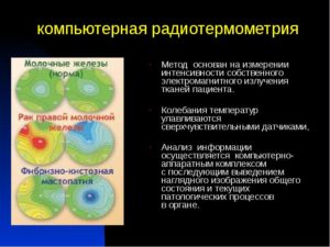 Ртм диагностика молочной железы
