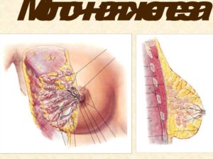 Где у женщин находятся молочные железы у