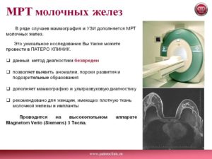 Мрт молочных желез сделать