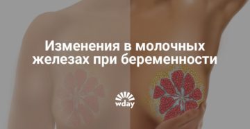 Изменения молочных. Молочные железы при беременности. Изменение груди при беременности. Изменения молочной железы при беременности. Набухание молочных желез.