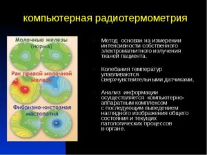 Радиотермометрия молочных желез где сделать