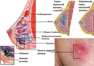В молочных железах много железистой ткани
