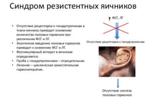 Резистентные яичники