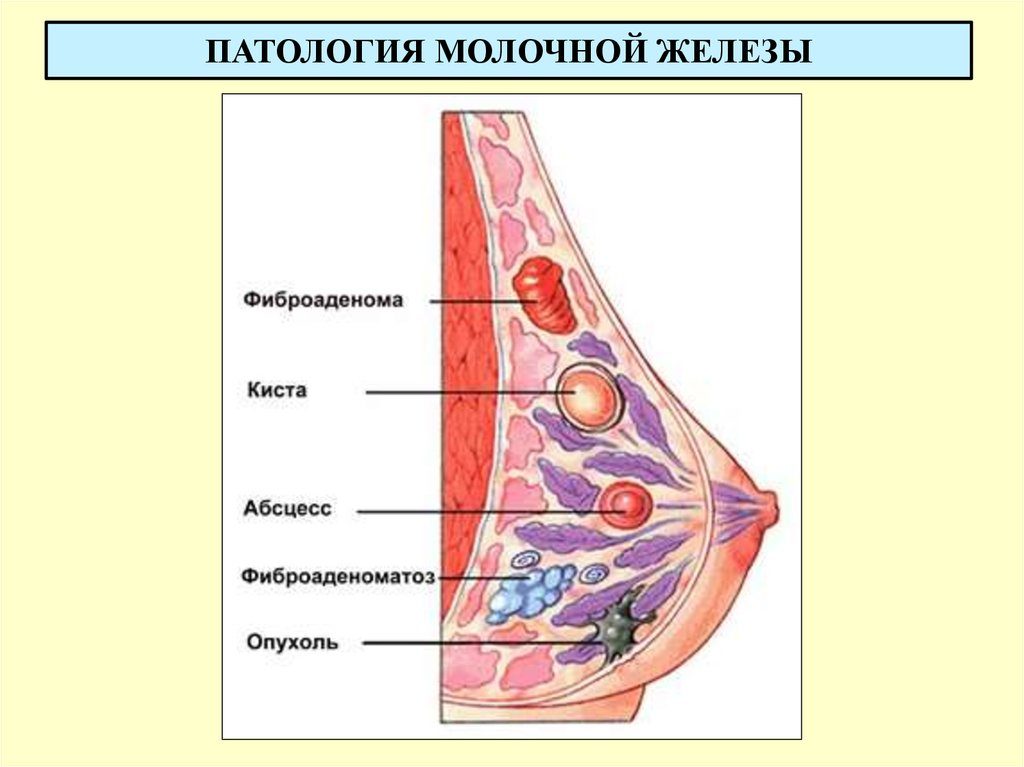 Патология молочной железы