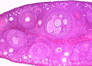 Гистология яичника