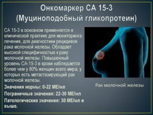 Онкомаркер молочной железы
